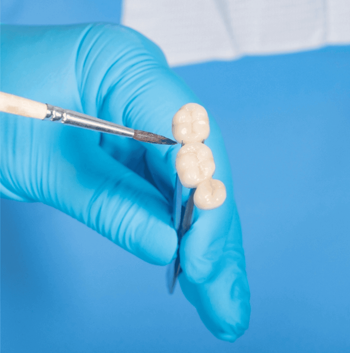 A dentist is applying dental glaze