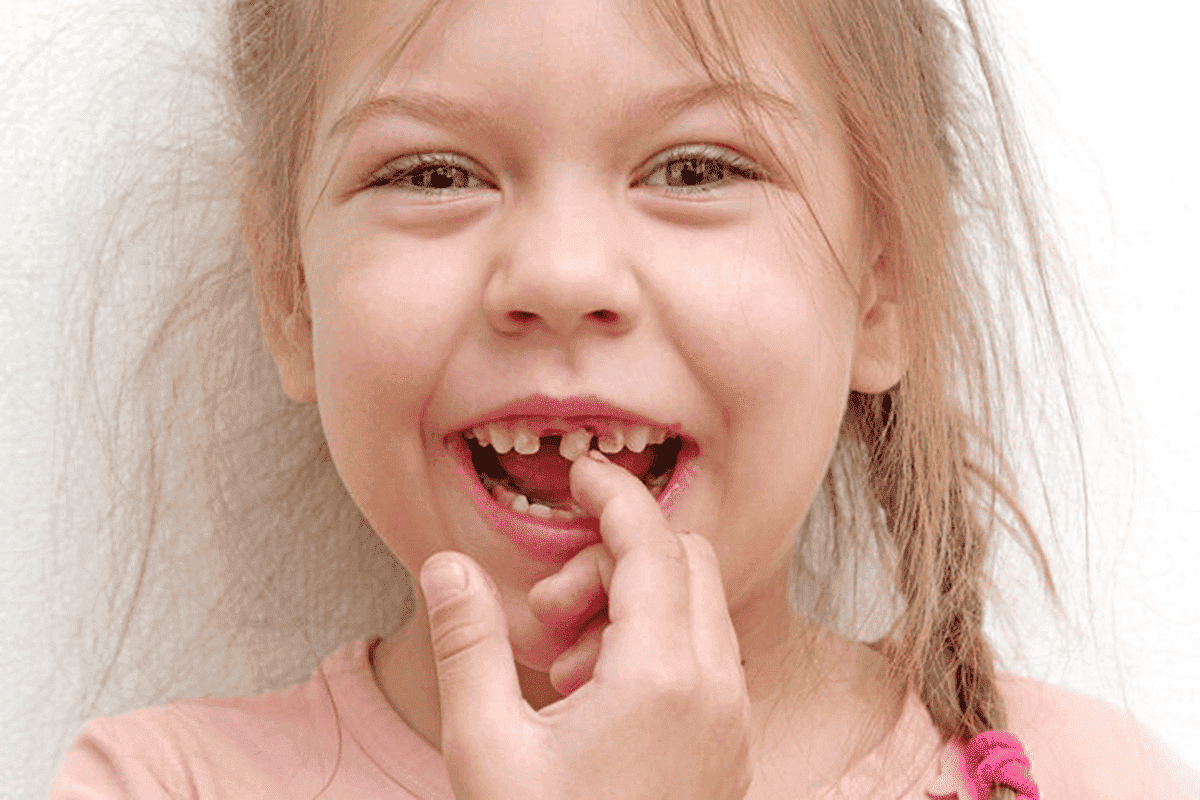 A joyful child proudly showcasing a wiggly tooth