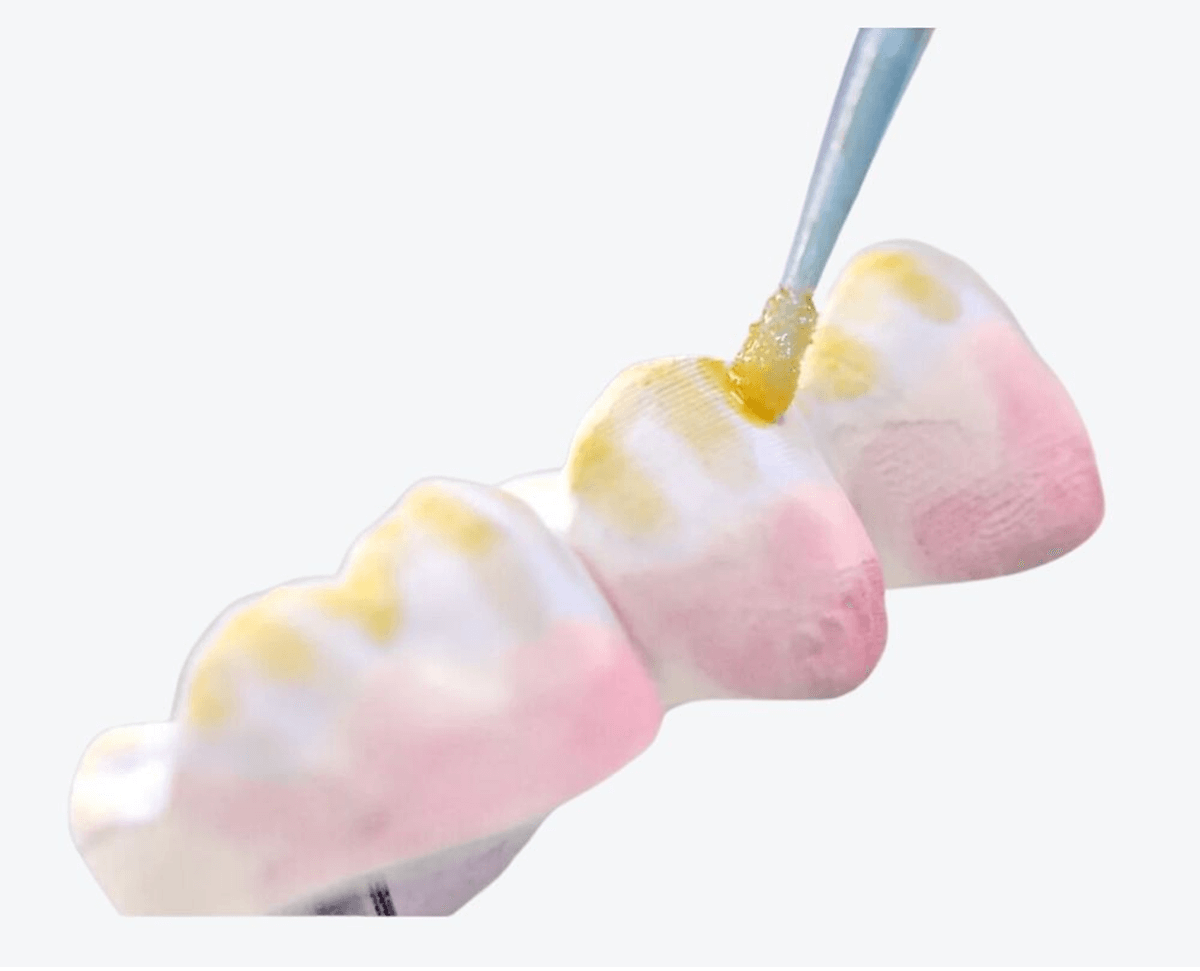 using a polishing bur to apply dental coloring liquid