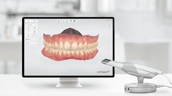 3D Dental Scan