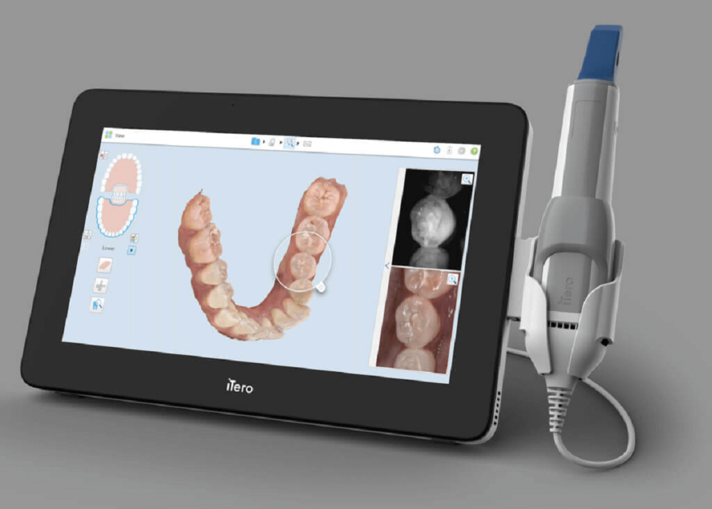 3D Dental Scanner Price List