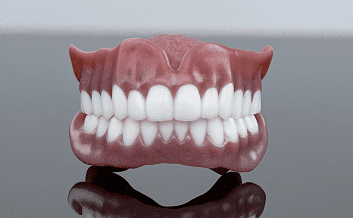 3D-Printed Dentures