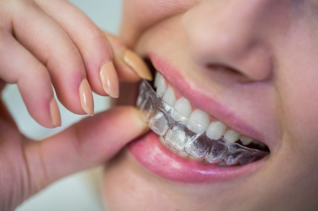 3D-printed dental braces