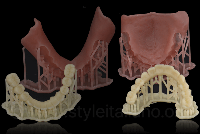 3d Printed Dentures