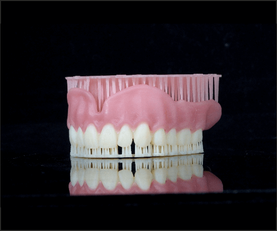 3d Printed Dentures