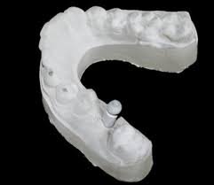 3d printed surgical guides cost