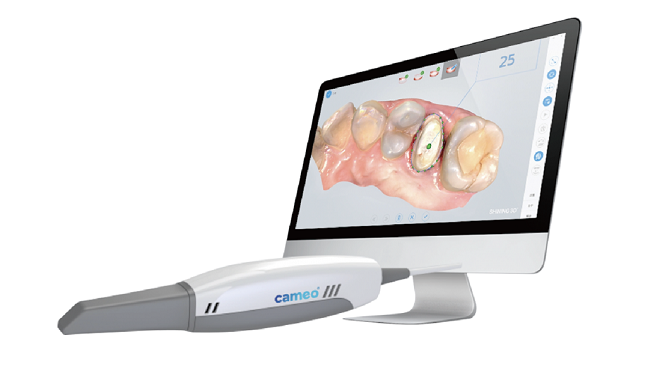Aidite Intraoral Scanner