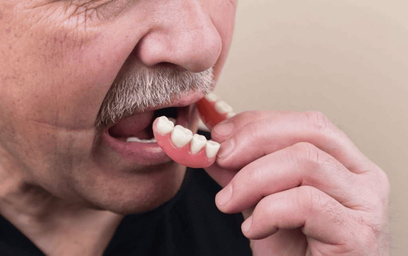 An old man is inserting his lower set of complete dental dentures.