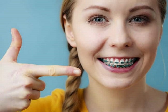 Are Metal Dental Braces Right for You