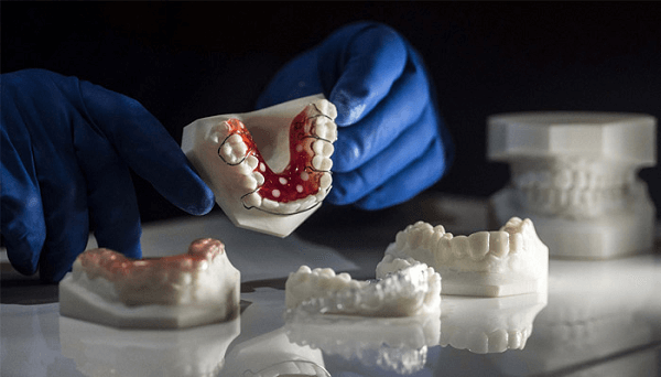 Benefits of using 3D printing software for dentistry