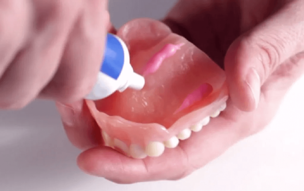 Best Dental Adhesive