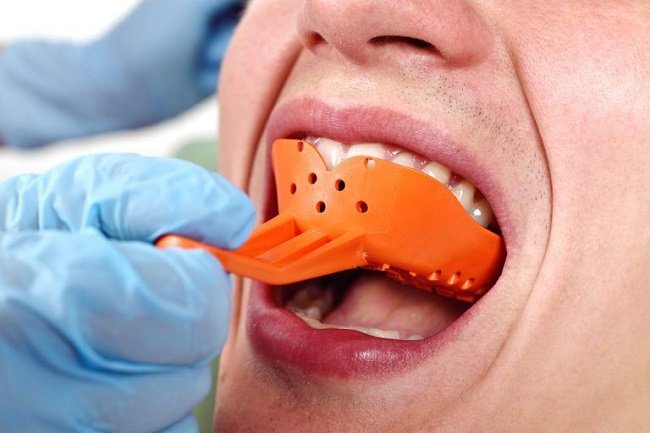 Best practices for taking dental impressions