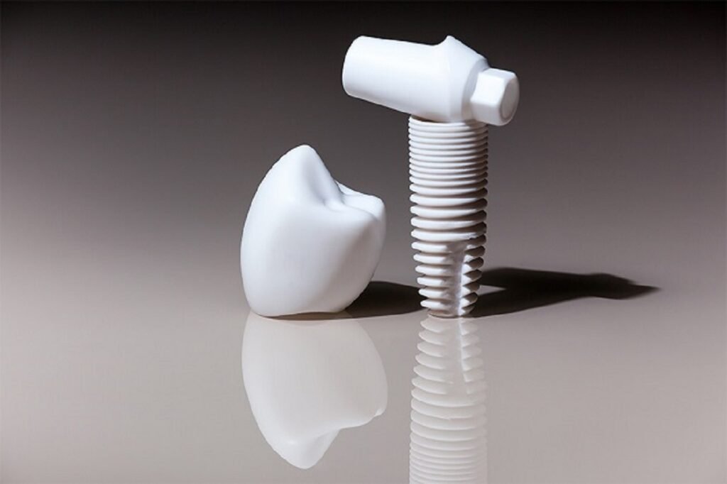 Ceramic Dental Implants: Safe, Metal-Free & Aesthetic