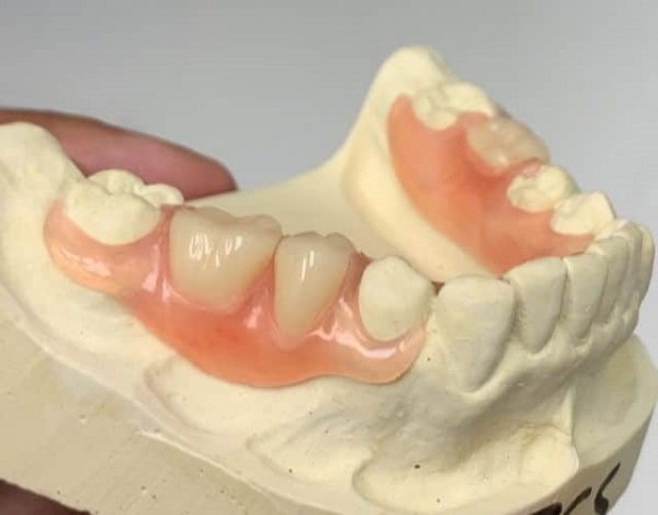Choosing denture material