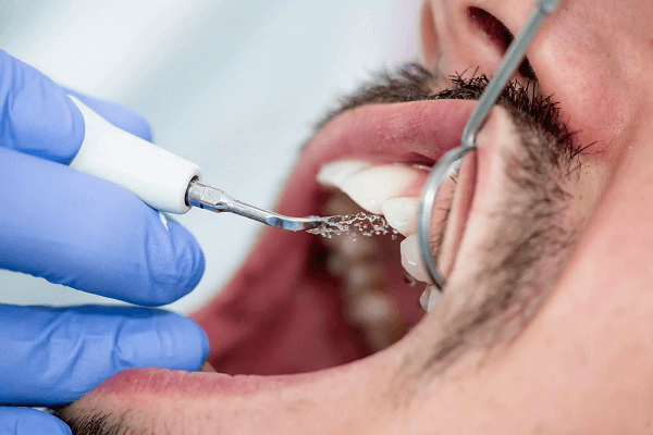 Clean and Dry the Teeth Area