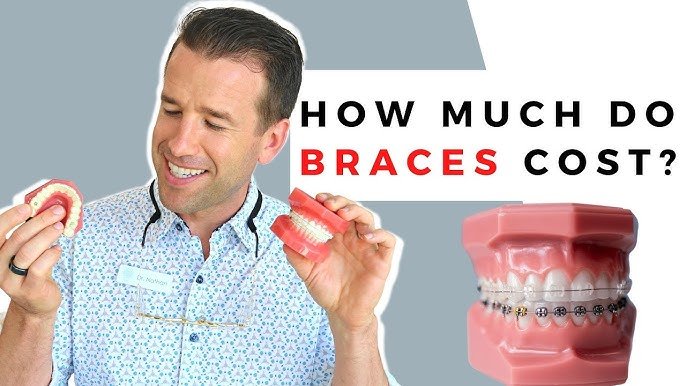 Cost Of Braces Without Insurance