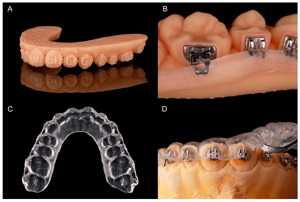 Custom Digital Brackets and Wires