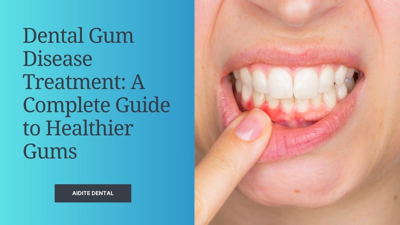 Dental Gum Disease Treatment A Complete Guide to Healthier Gums