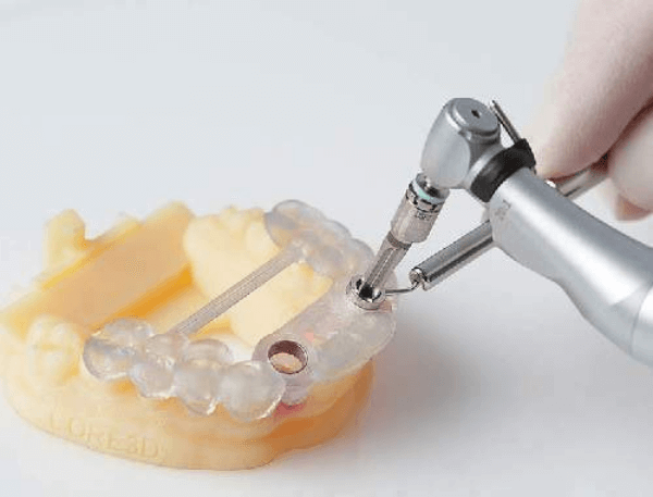 Dental Implant Surgical Guide