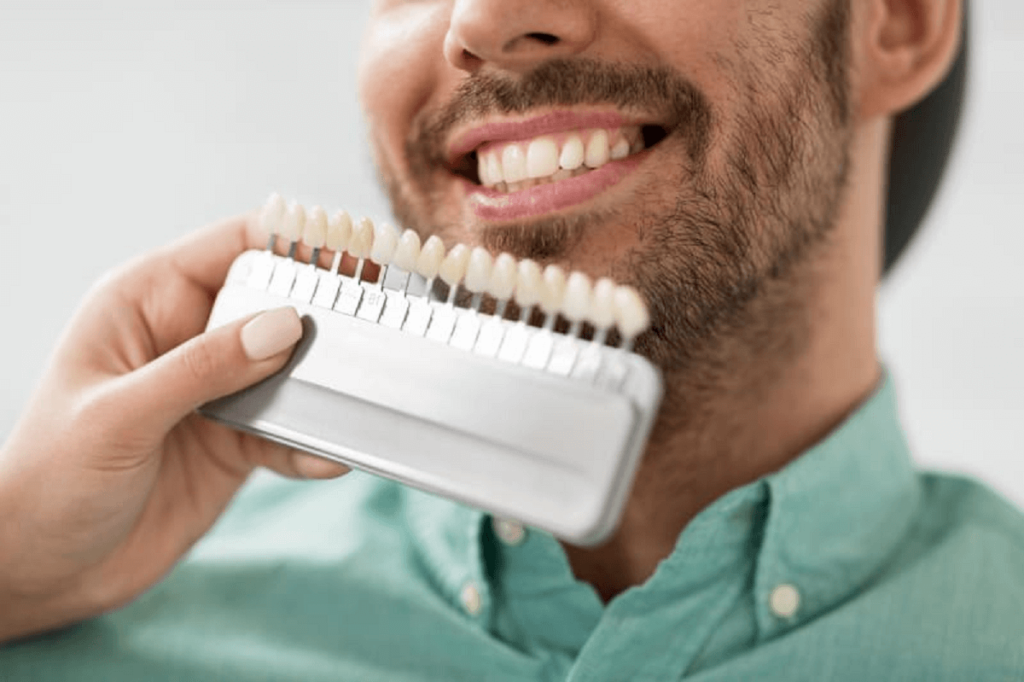 Dental Shade Guide
