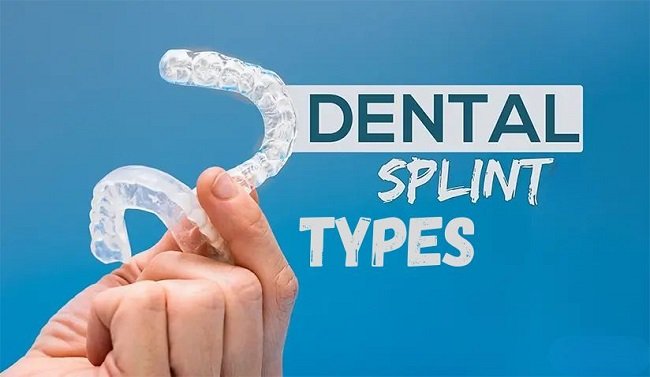Dental Splint Types