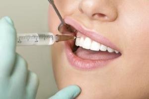 Dental anesthesia
