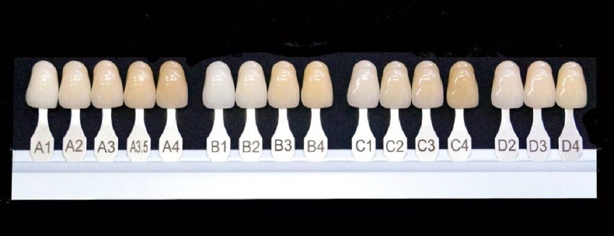 Dental implant color chart