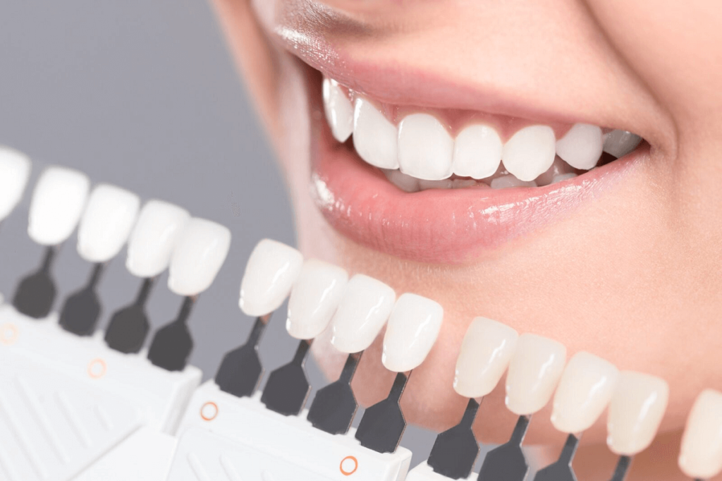 Dental shade guide tutorial