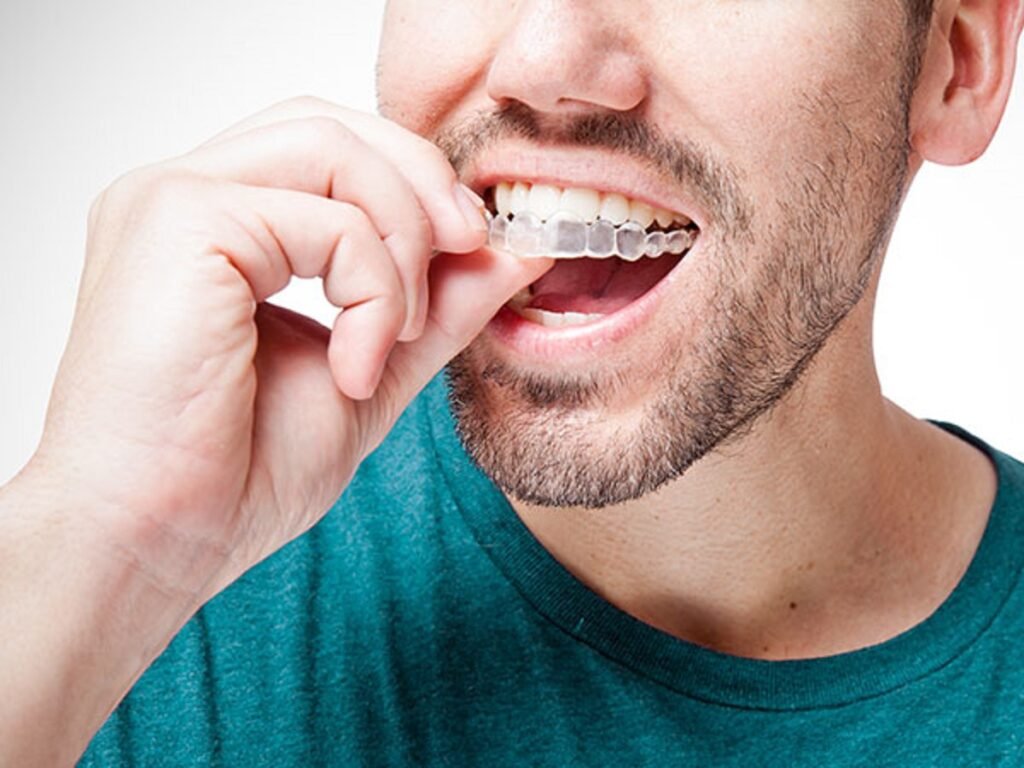 Dental splint types