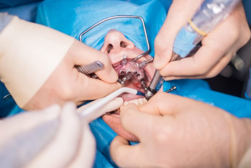 Dental surgery