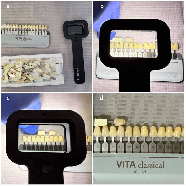 Denture Shade Guides under Natural Lighting