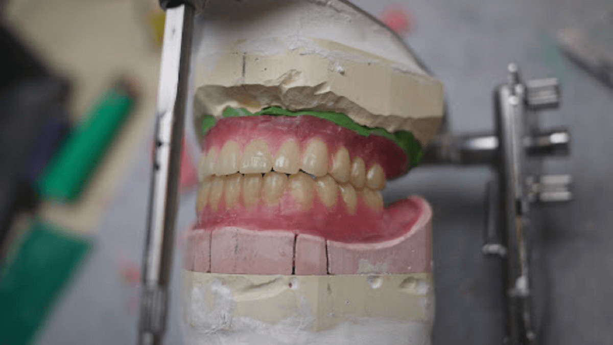 Denture Try-In