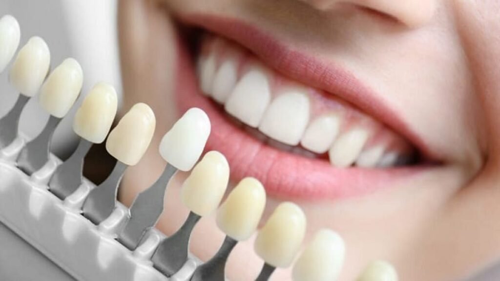 Denture color chart