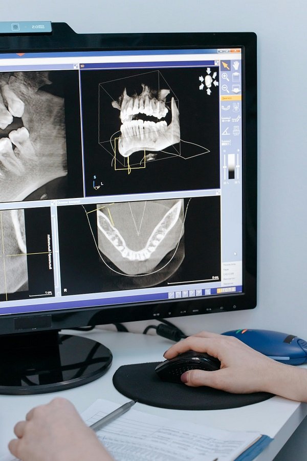 Different Types of X-Rays