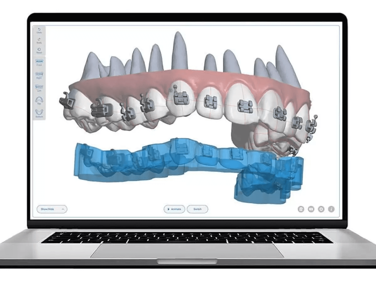 Digital Orthodontics