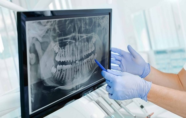 Digital Radiography Systems