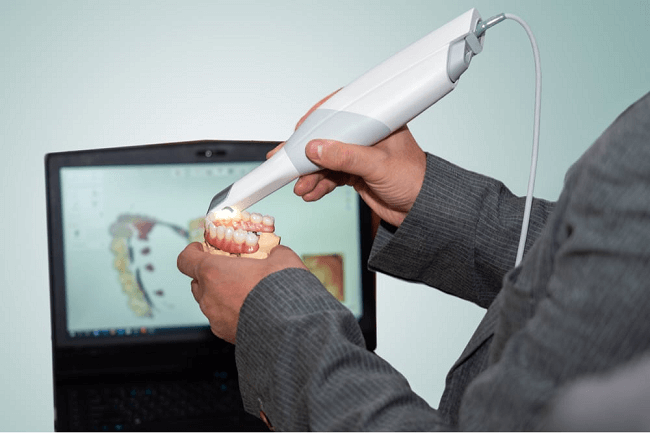Digital scanner for taking digital impressions