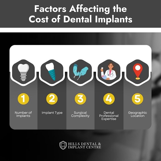 Factors That Affect Dental Implants Cost
