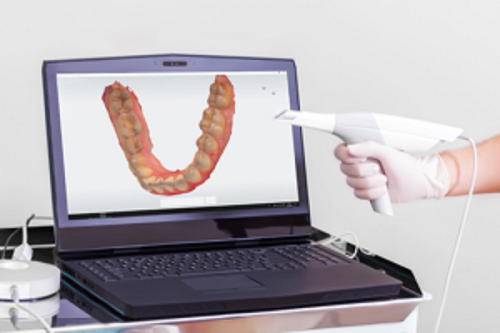 Factors That Influence the Price of 3D Dental Scanner