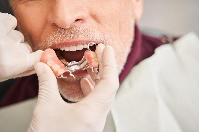 Fitting Appointment of denture