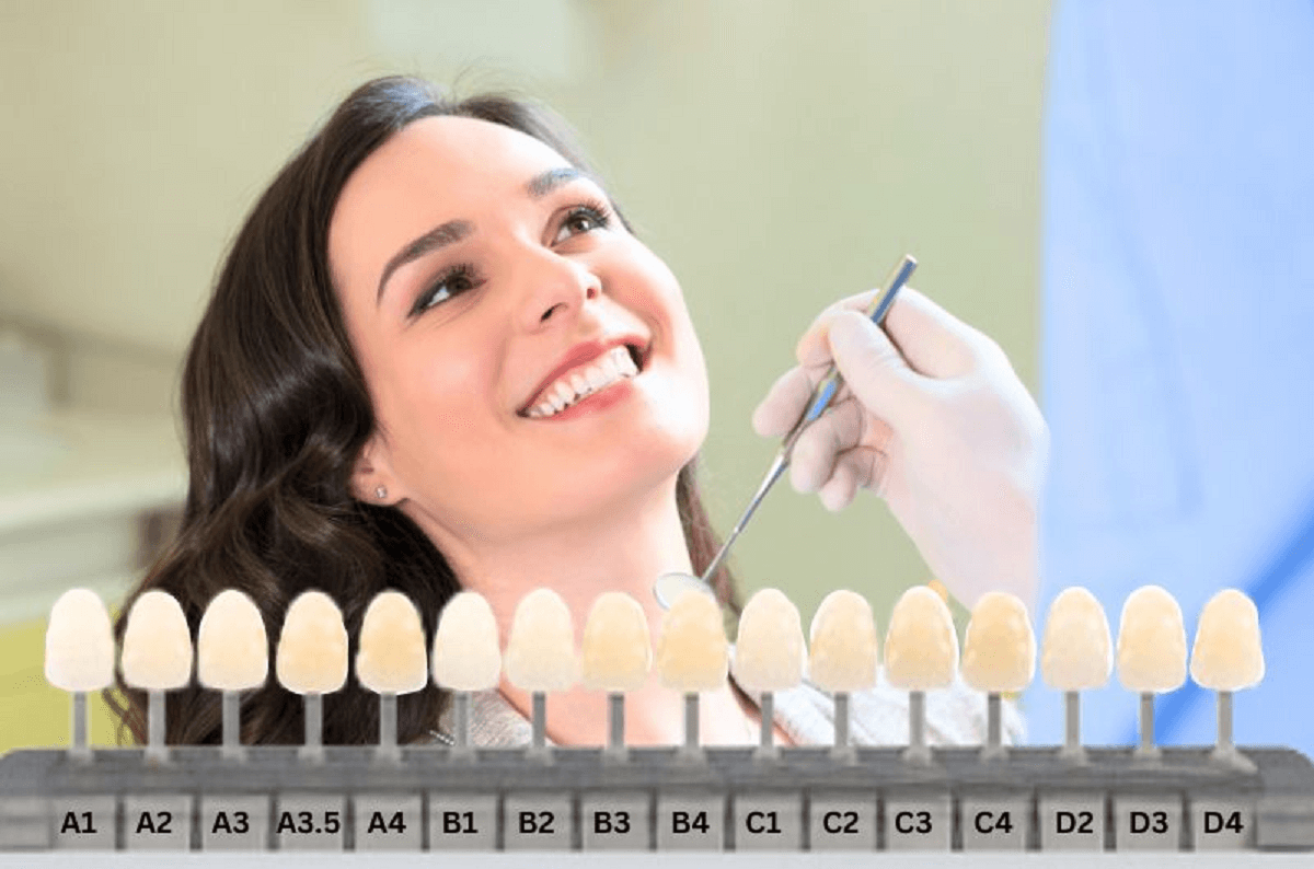 Five Types of Dental Shade Guides