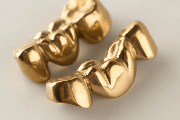Gold Dental Bridge