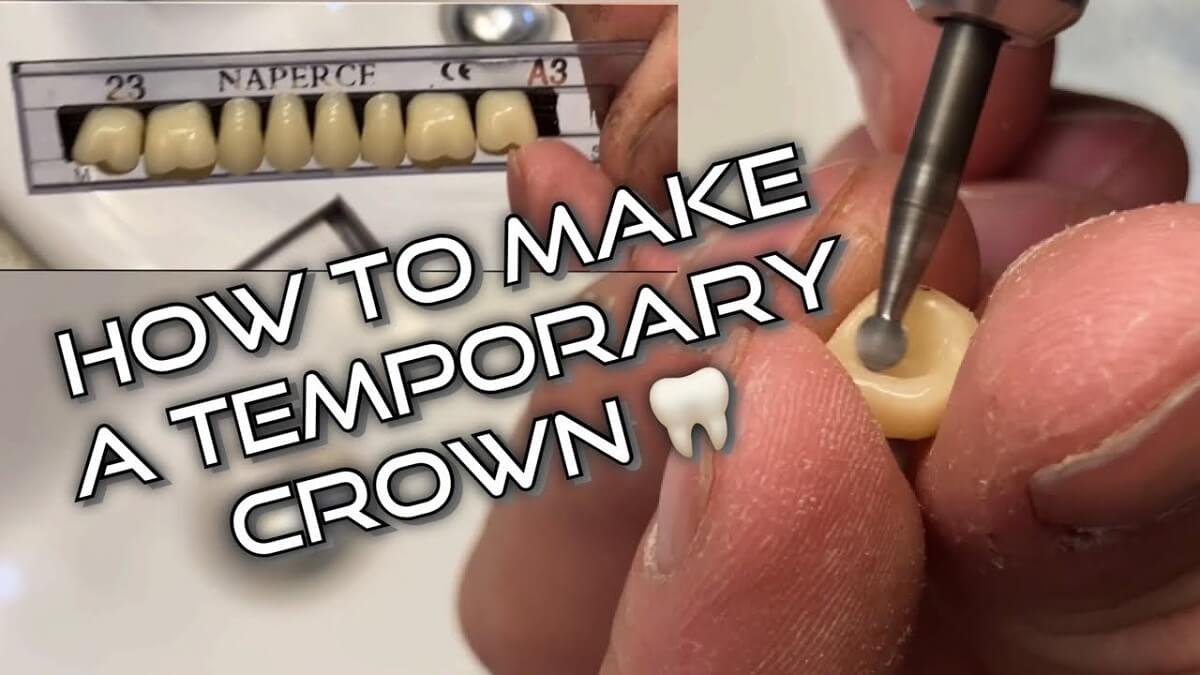 How to Make a Temporary Dental Crown