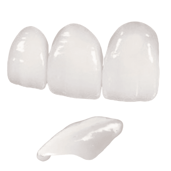 Illustration of dental zirconia veneers