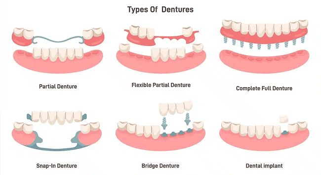 Image of different adhesive dentures available