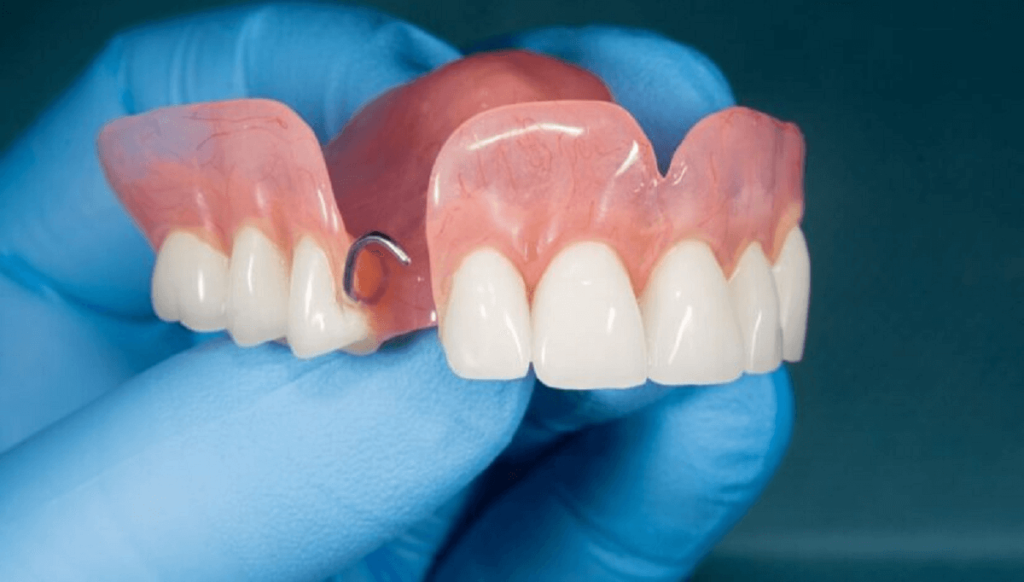 Immediate Dentures