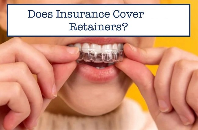 Insurance Coverage for Retainers
