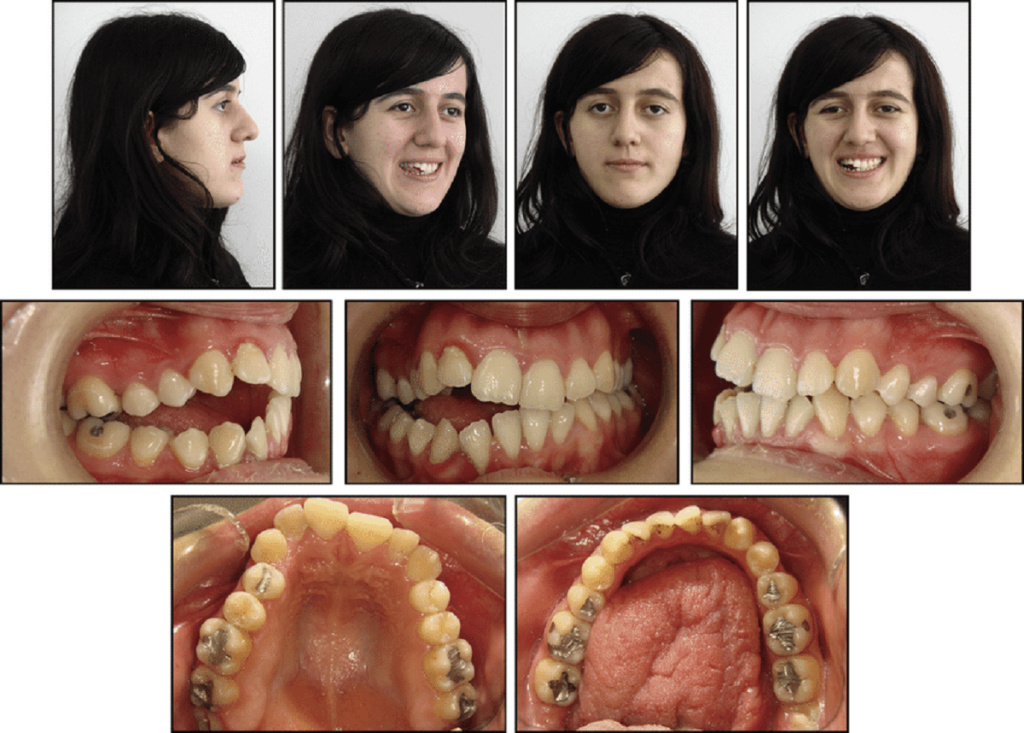 Intraoral And Extraoral Photographs