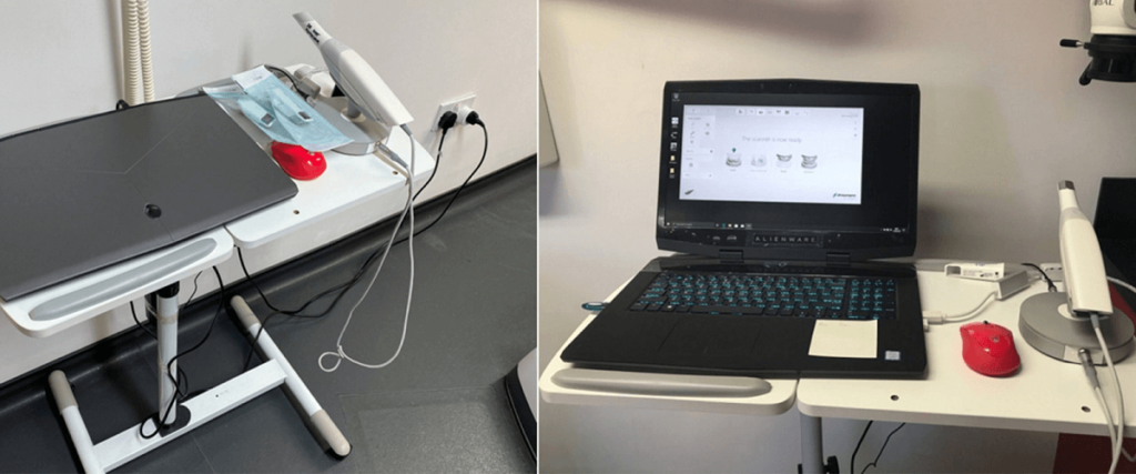 Intraoral Scanner Vs Extraoral Scanner