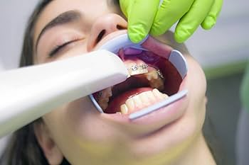 Intraoral scanner comparison